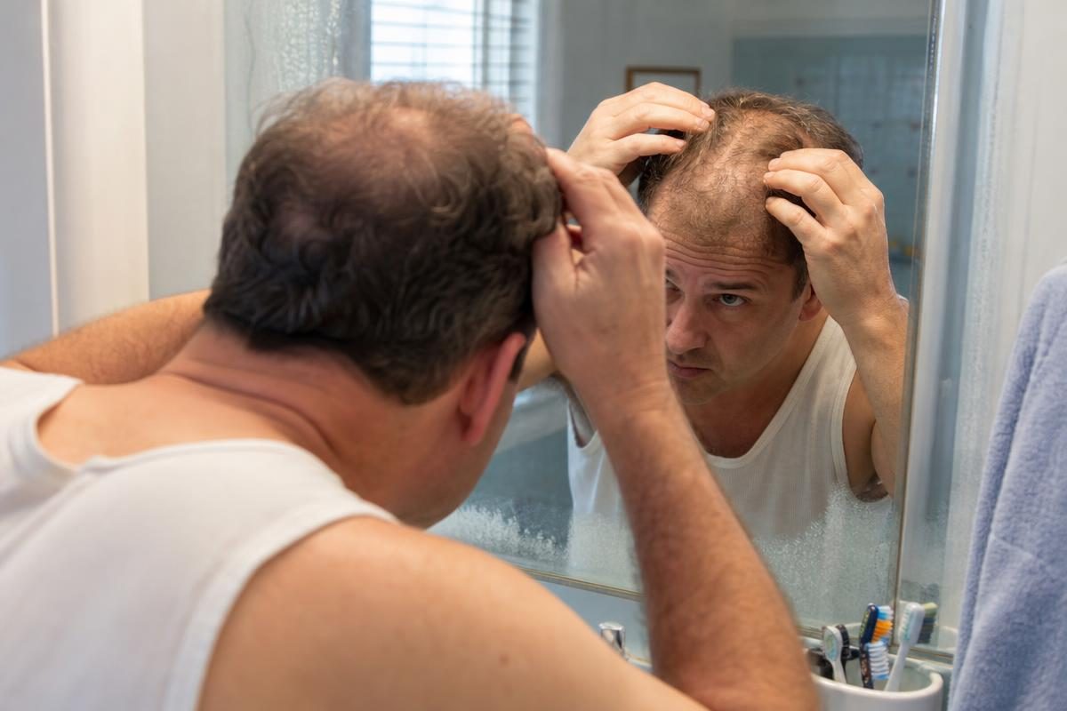 A man checking his thinning hairline in the mirror while considering Hair Club for Men