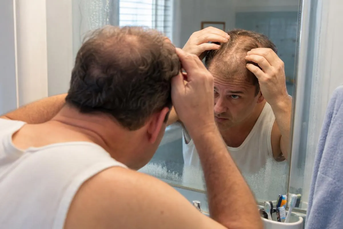 A man checking his thinning hairline in the mirror while considering Hair Club for Men